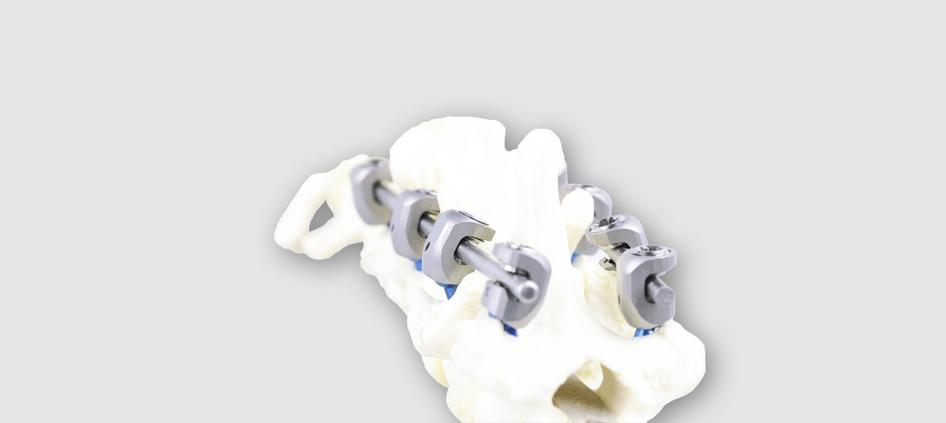 LeiPED Pedicle Screw System