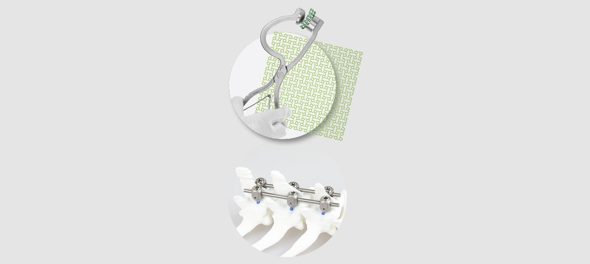 Neuro and Spinal Systems